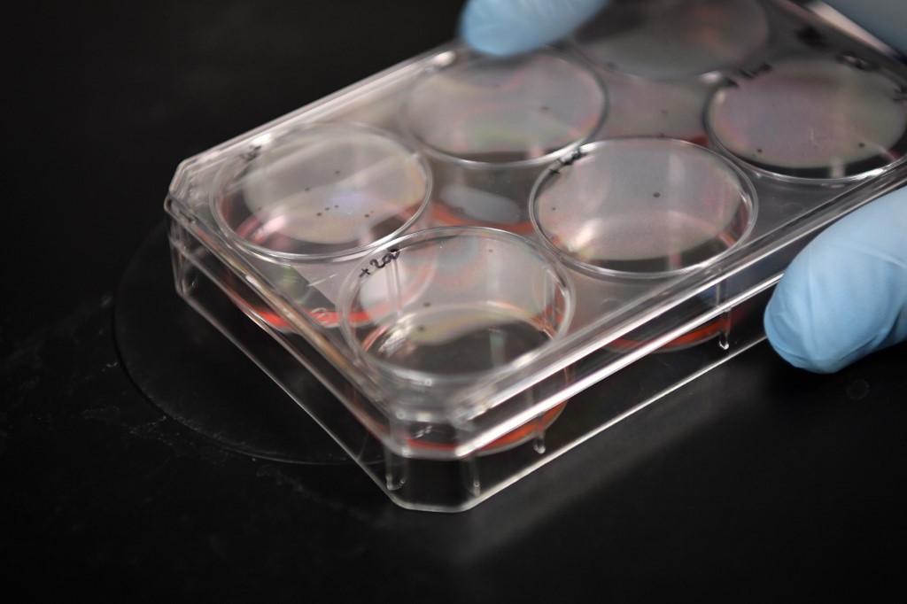 Brasil comienza a probar la vacuna de la Universidad de Oxford en plena pandemia