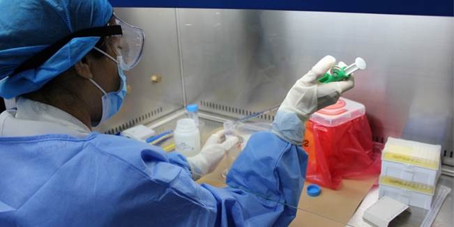 Fecobiove propone implementar protocolo para realizar pruebas de antígeno en más laboratorios | Venezuela