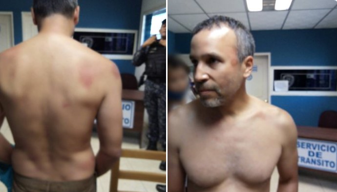 Odontólogo Williams Arrieta sufrió una fractura y politraumatismo durante su detención