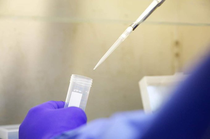 Laboratorios de salud pública procesarán las pruebas de antígenos en Venezuela