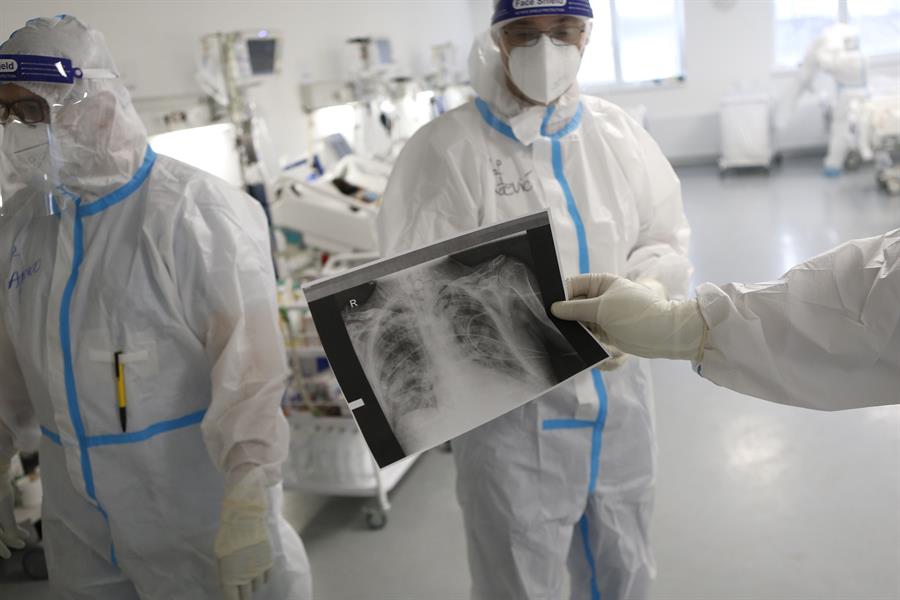 Acumulación de virus en los pulmones, principal causa de muerte por covid-19