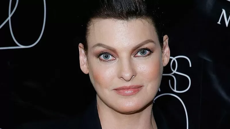 Linda Evangelista rompe su silencio sobre el tratamiento estético que la dejó "permanentemente deformada"