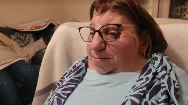 Janet Craven nació con un raro trastorno genético llamado síndrome de Treacher Collins.