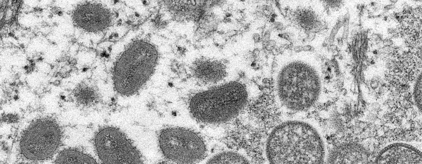 ¿Debería preocuparnos la viruela del mono?: 8 claves que debe saber