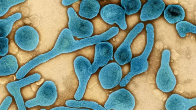 Virus de Marburgo: qué es, cómo se trasmite y cómo prevenir la enfermedad infecciosa detectada otra vez en África