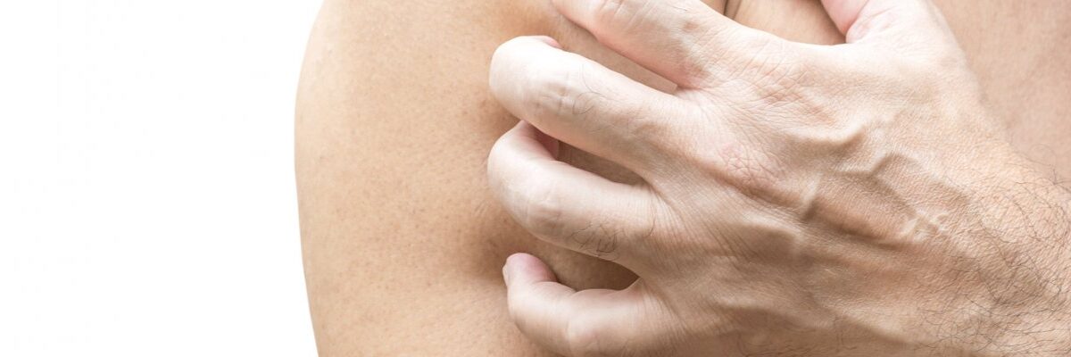¿Por qué nos rascamos? La sorprendente ciencia detrás del picor