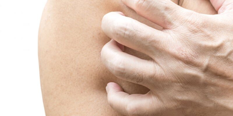 ¿Por qué nos rascamos? La sorprendente ciencia detrás del picor